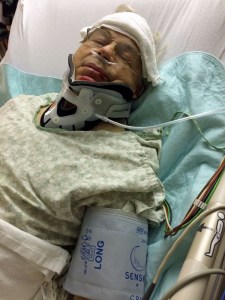 One instant on my bike on a beautiful day, the next conscious instant in an ICU with broken bones; very humbling.